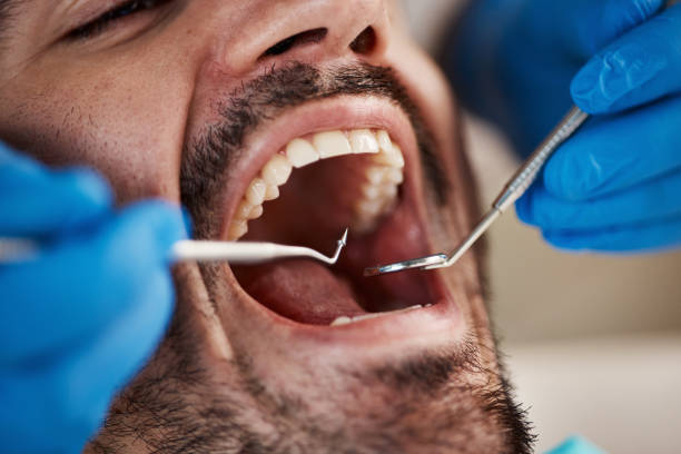 Best Root Canal Treatment  in Spencerville, MD